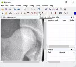 Digimizer screenshot 1